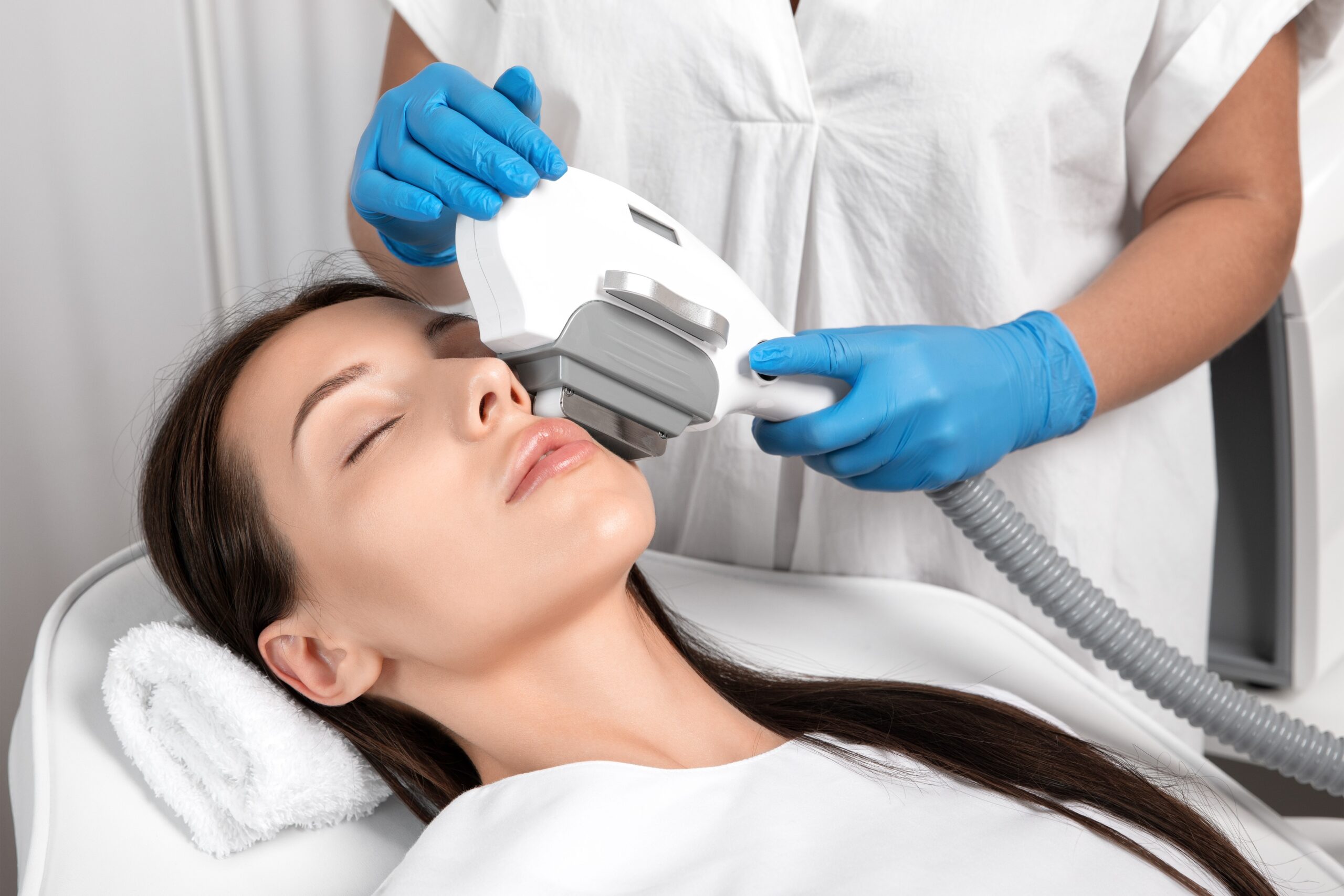 IPL Acne Chest Treatment - Gentle Touch Lasers